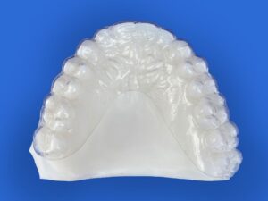 Retention appliances - Orthodontic Laboratory